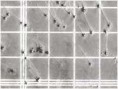 /album/fotogaleria-in-vitro/przygotowanie-plemnikow-jpg/